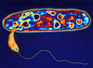 New Study Shows How Bacteria Get Into The Lungs Nexus Newsfeed   A99939ecbcb75112a3c3c5cbad4d9500 