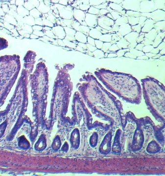 This photograph shows villi from an older gut.