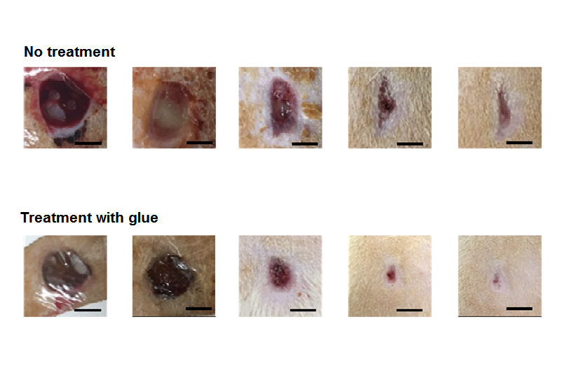 The wounds that received the new treatment (bottom) showed less scarring than those that didn’t (top)