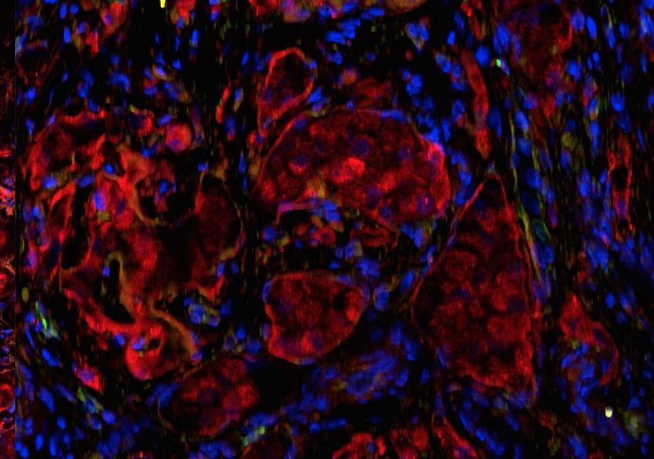 Fluorescence microscopy of islets in the omentum transplanted within the biologic scaffold. In red (insulin staining) and blue (DAPI nuclear staining). 