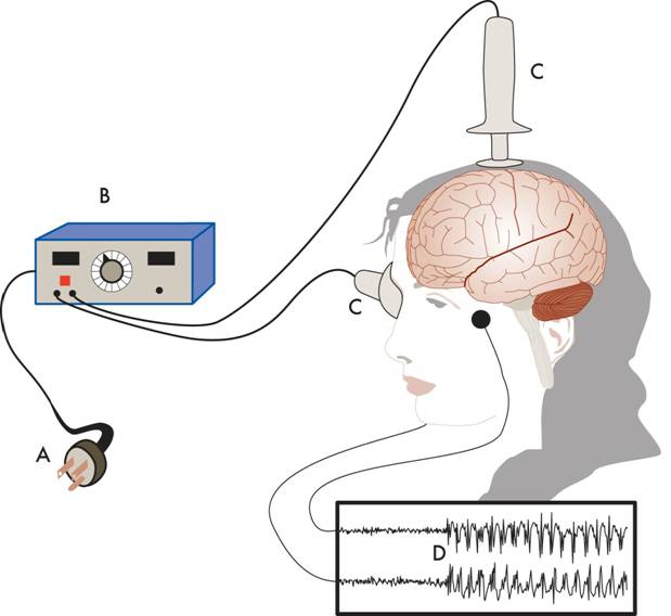 Ban electroshock (ECT) device being used on children, the elderly and ...