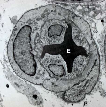  Blood vessel with an erythrocyte (red blood cell, E) within its lumen, endothelial cells forming its tunica intima (inner layer), and pericytes forming its tunica adventitia (outer layer)   Read more at: https://medicalxpress.com/news/2017-06-d-printed-p