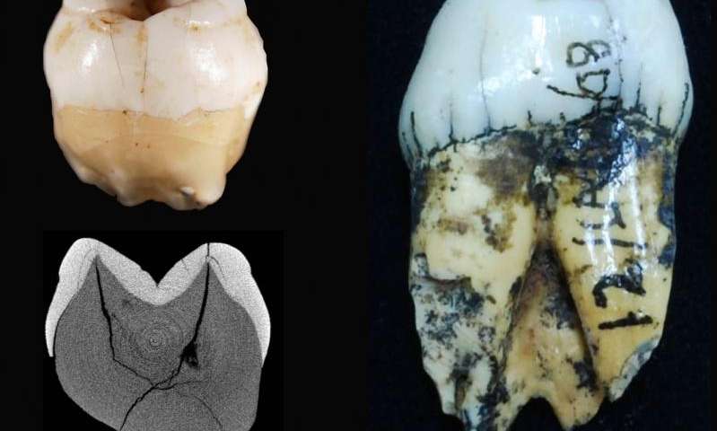 Lida Ajer modern human tooth (left top) with its corresponding scanned image (left bottom) compared to an orangutan tooth (right). 