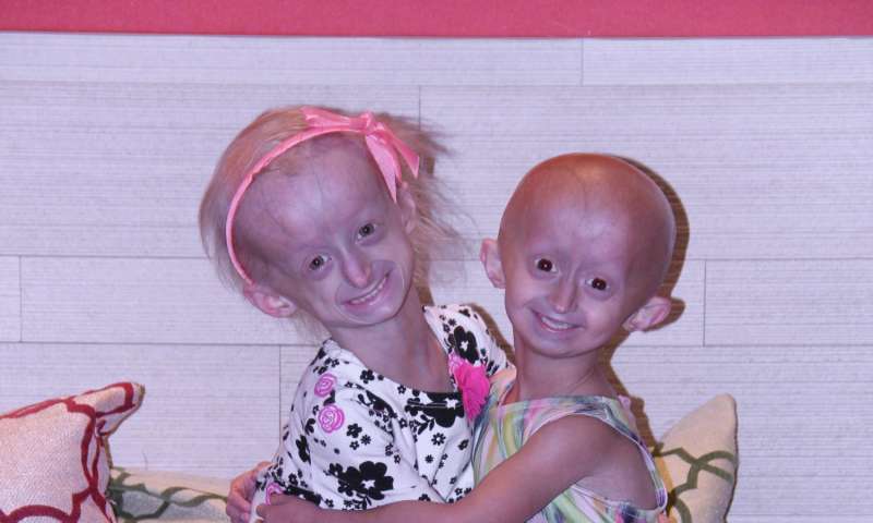 Progeria is a childhood disease with symptoms that resemble accelerated aging. Many affected patients die of heart disease brought on by weakened blood vessels before the age of 14. A single, random point mutation is responsible for the few hundred cases 