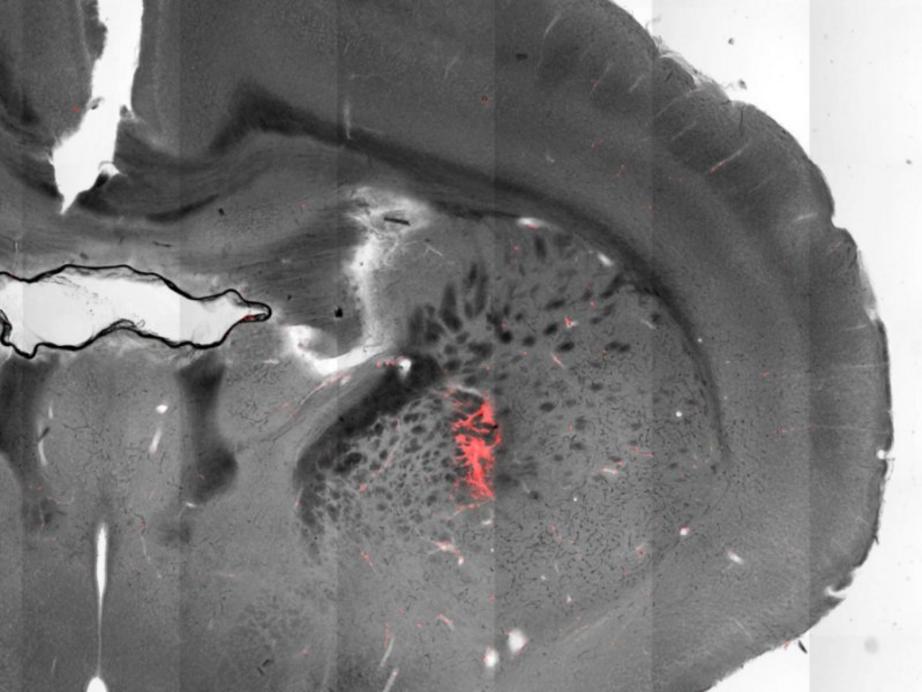 Scientists have used magnetic nanoparticles to stimulate neurons deep in the brain to evoke body movements of mice. This image shows a section of a mouse brain with injected magnetic nanoparticles (colored red) covering targeted cells in the striatum.  Cr