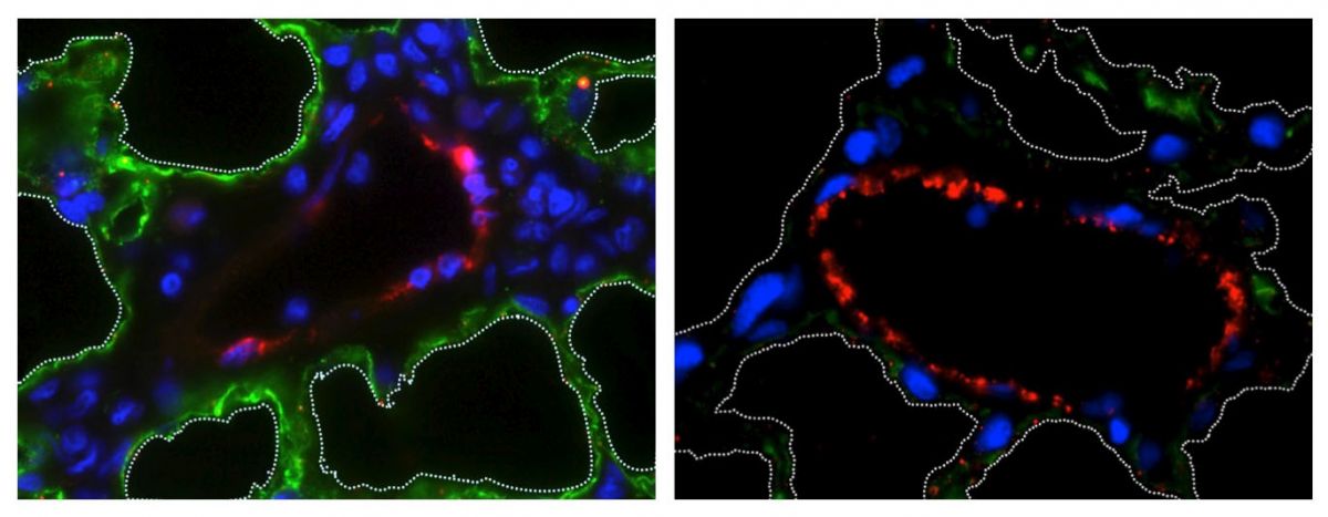 Left: Intact lung with epithelial cells (green) and vascular cells (red). Right: Lung after epithelial removal. Dashed lines indicate alveoli. 