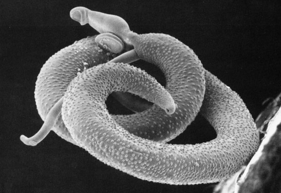 Schistosoma mansoni is an obligate endoparasite of human blood vessels.
