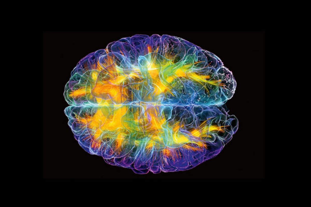 Источник долголетия. Радужный мозг. Радужные мозги. Интересная неврология. Изображение мозга в радуге.