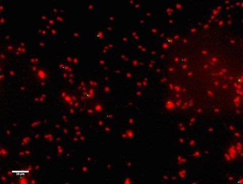 This is a microscopic image of Staphylococcus aureus, a problematic pathogen that infects the airways of children with cystic fibrosis.