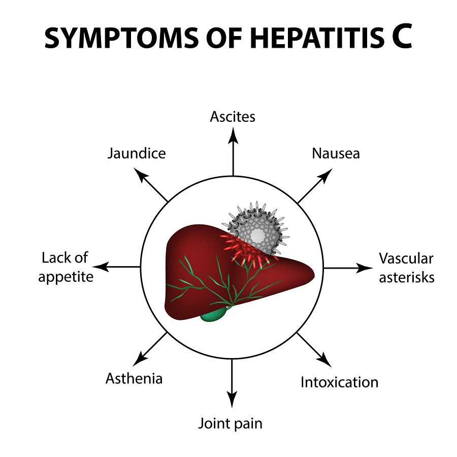 Natural And Non-toxic Options For Treating Hepatitis C Or Liver ...