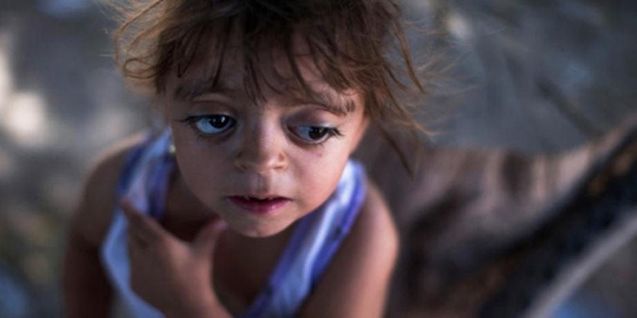 Camila Veron, aged 2, born with multiple organ problems and severely disabled, in Chaco province, Argentina